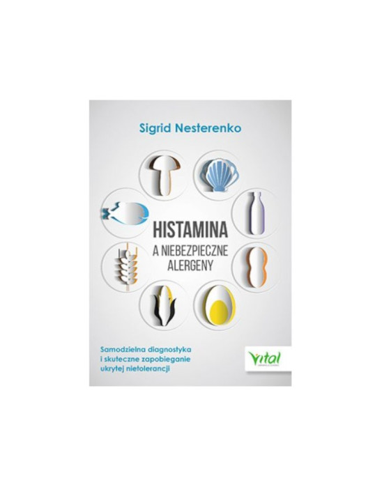 Histamina a niebezpieczne alergeny | Sigrid Nasterenko