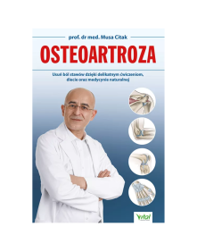 Osteoartroza | Prof. dr med. Musa Citak